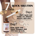 Joint Whitening Oil Manufacturer - 7-day Essential 50ml