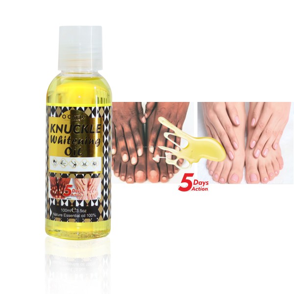 Joint Whitening Oil Manufacturer - 5-day Treatment 100ml