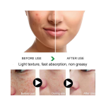 Whitening Capsules Supplier - OEM Anti Melasma DIM KSM-66