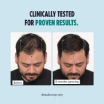 Men's Hair Growth Manufacturer - Clinically Tested Thicker Hair