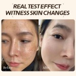 Freckle Cream Manufacturer - OEM Whitening Moisturizing Custom