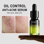 Face Serum Manufacturer - 14 Day Acne Solution Custom Logo