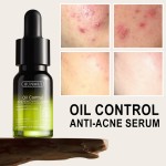 Acne Serum Manufacturer - Brightening Anti Aging Hyperpigmentation