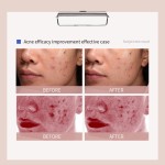 Acne Essence Factory - Pore Shrinking Mouth Closing Solution