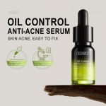 Face Serum Manufacturer - 14 Day Acne Solution Custom Logo