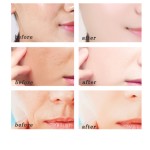 Skin Care Set Factory - Custom Anti Aging Acne Whitening