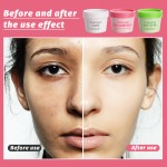 Clay Facial Mask - Kaolin Rose Whitening Acne Care