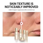 Probiotic Skincare Set - Ance Balance Brightening