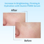 Salmon DNA Serum - OEM PDRN Anti-Aging Ampoule Manufacturer