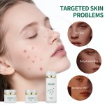 Snail Eye Care Set - Hydrogel Patches Essence Cream