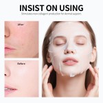Collagen Face Mask - Nano-Flexible Carrier Technology