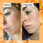 Sheep Placenta Serum - Vitamin E Anti-Aging Repair