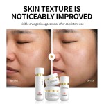 Hyaluronic Trial Kit - Four-Step Moisture Ritual