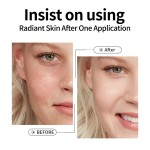 Vitamin C Serum - Hyaluronic Acid Anti-Aging