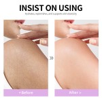 Brightening Body Butter - Plant-based Hyperpigmentation