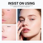 Hyaluronic Acid Toner - 4D Centella Brightening Care