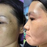 Whitening Cream Factory - Private Label Korean Anti Freckle Face