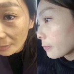 Whitening Cream Factory - Private Label Korean Anti Freckle Face