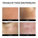 Skincare Set Manufacturer - OEM Organic Blemish Freckle Removal