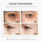 Eye Cream Manufacturer - Private Label Dark Circle Wrinkle Removal