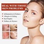 Powder Facial Mask Manufacturer - Best Selling Acne Removal Mask Tool