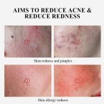 Powder Facial Mask Manufacturer - Best Selling Acne Removal Mask Tool