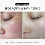 Skincare Set Manufacturer - OEM Organic Blemish Freckle Removal