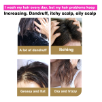 Shampoo - Aloe Vera Anti Lice Control