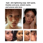 Kojic Acid Soap - Whitening Bar Soap Wholesale