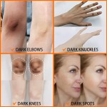 Whitening Skin Care Set - Dark Spot Removal Care