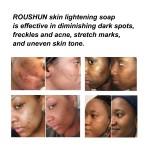 Kojic Acid Soap - Whitening Bar Soap Wholesale