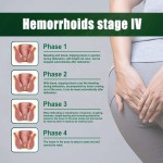 Hemorrhoids Ointment - Pruritus Relief Treatment
