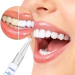 Teeth Whitening Pen - 5ml Peroxide Gel Home Use