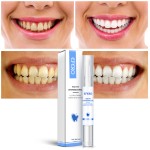 Teeth Whitening Pen - Portable Home Use Tool
