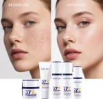 Skin Care Set - 5 Piece Whitening Series