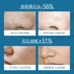 Clay Mask - Pore Cleansing Acne Treatment