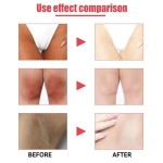 Underarm Cream - Whitening Brightening Care