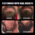 Beard Growth Oil - Natural Conditioning Formula