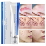 Skin Repair Gel - Acne Mark Stretch Mark Care