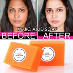 Kojic Acid Soap - Glutathione Whitening Bar