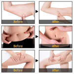 Cellulite Cream - 3 Days Body Slimming Formula