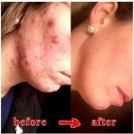 Handmade Soap 100g - Organic Kojic Acid Cleanse