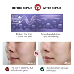 Face Cream - Retinol Anti-Aging Moisturizer