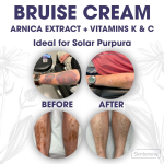 Bruise Cream 4oz - Arnica Skin Renewal