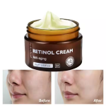 Face Cream - Retinol Anti-Aging Moisturizer