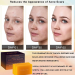 Whitening Soap - Turmeric Kojic Acid Dark Spot