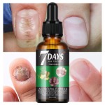 Nail Treatment Serum 30ml - Fungus Bacteria Repair