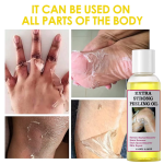 Peeling Oil - Extra Strong Scar Whitening