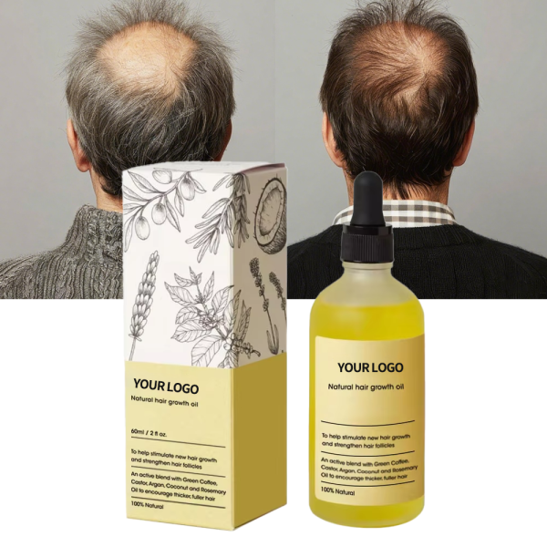 Hair Growth Serum - Organic Castor Almond Oil