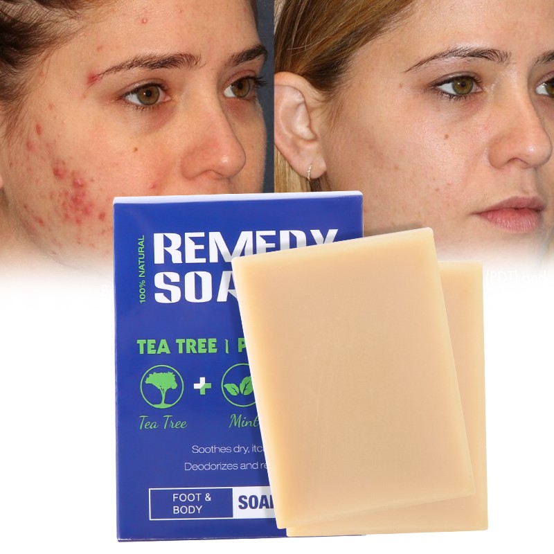 Hair Soap - Batana Oil Scalp Repair